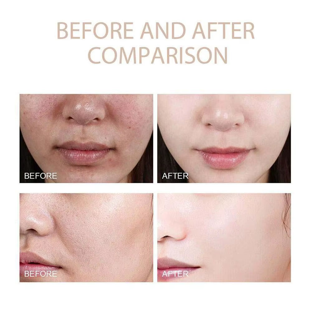 Dr. Melaxin Peel Shot™️ White and Black Rice Exfoliating Oil