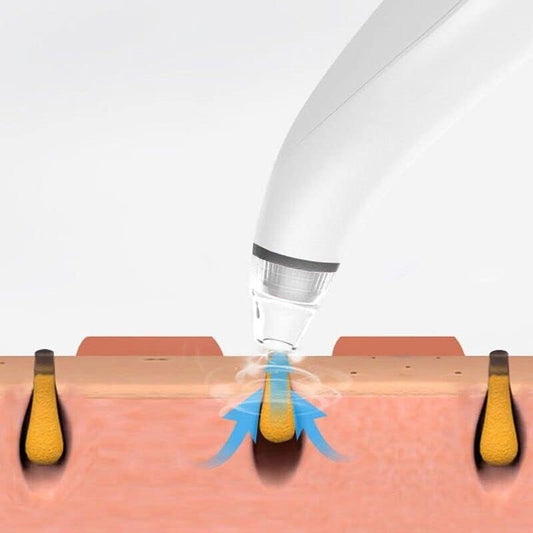 SilkSuction Elite™️ Electric Blackhead Remover